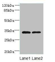TMEM71 antibody