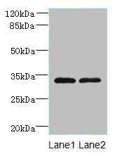TMEM71 Antibody
