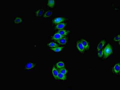 TMEM82 Antibody