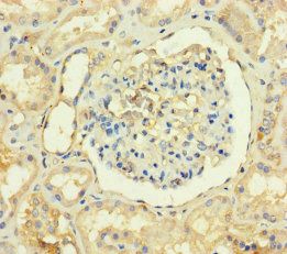 TMEM82 Antibody