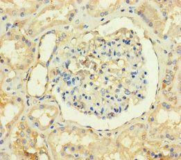 TMEM82 antibody