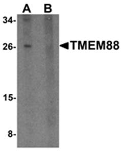 TMEM88 Rabbit Polyclonal Antibody
