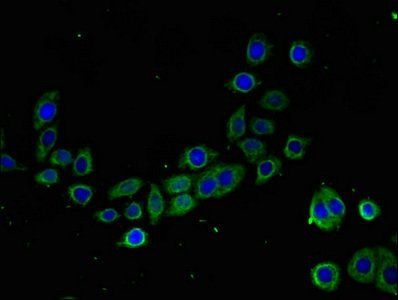 TMIGD2 Antibody