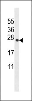 TMM18 antibody