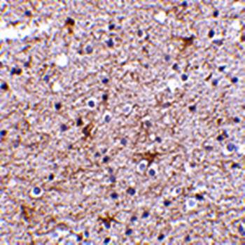 TMP21 Rabbit Polyclonal Antibody