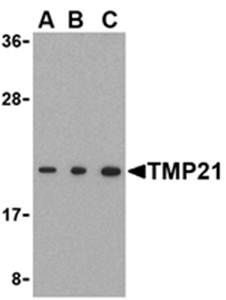 TMP21 Rabbit Polyclonal Antibody