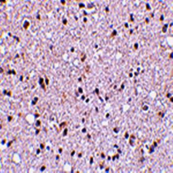 TMP21 Rabbit Polyclonal Antibody