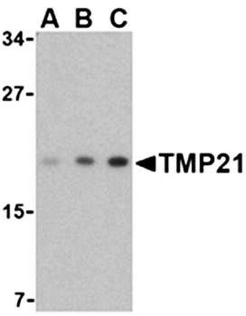 TMP21 Rabbit Polyclonal Antibody