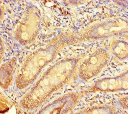 TMPRSS11D Antibody