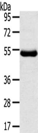 TMPRSS11D Antibody