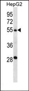 TMPRSS13 antibody