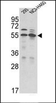 TMPRSS2 antibody