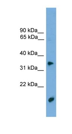 TMPRSS3 antibody