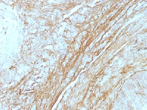 Tenascin C (Stromal Marker for Epithelial Malignancy) Antibody