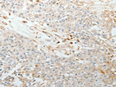 TNC Antibody