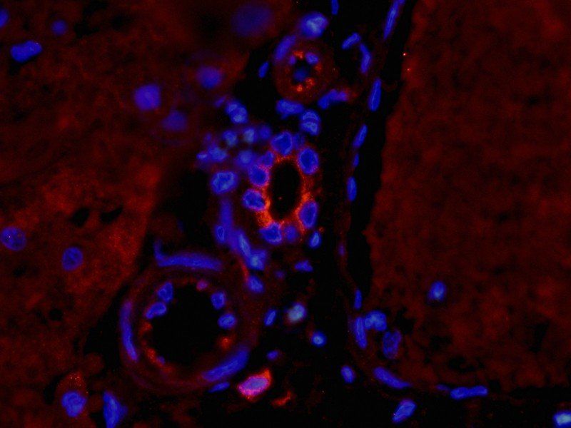 TNF alpha antibody