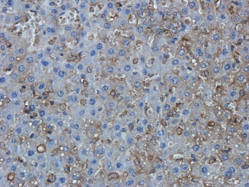 TNF alpha antibody