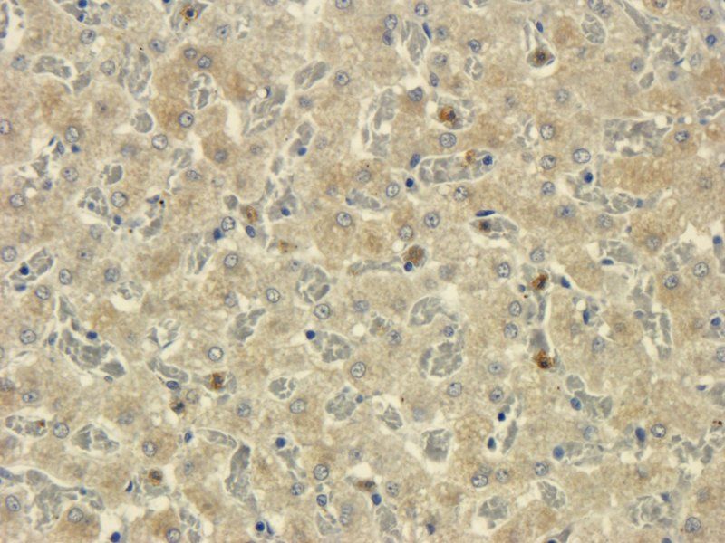 TNF alpha antibody