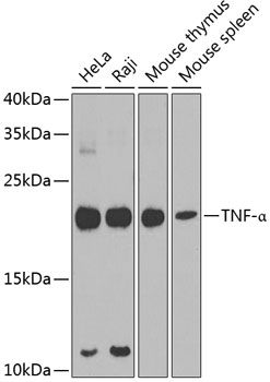 TNF antibody