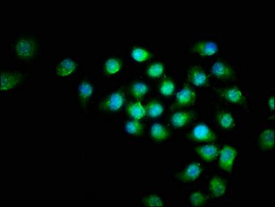 TNF antibody