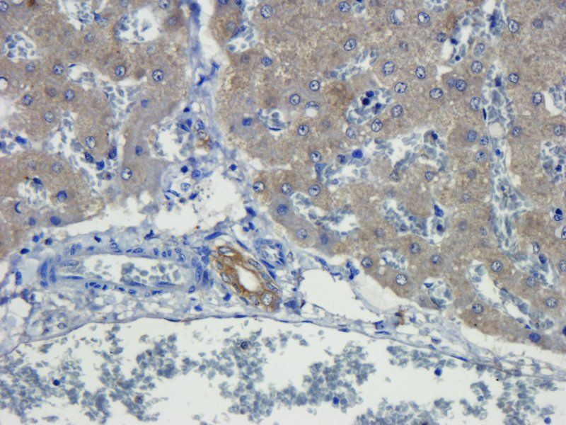 TNF alpha antibody