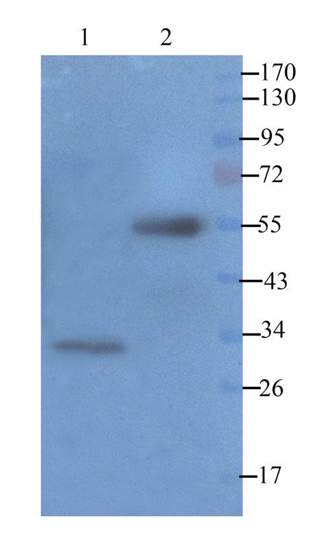 TNF alpha antibody