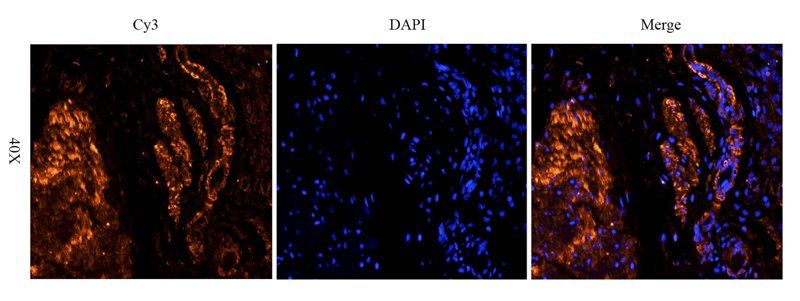 TNF alpha antibody