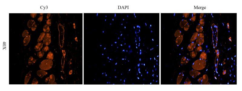 TNF alpha antibody