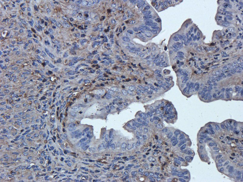 TNF alpha antibody