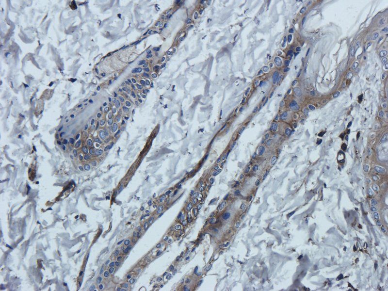 TNF alpha antibody