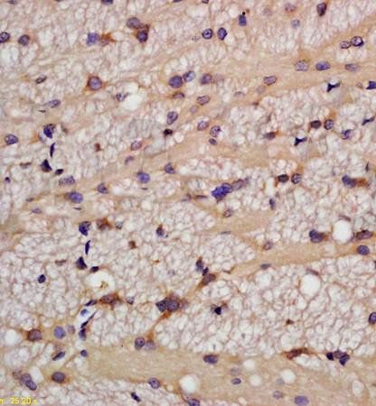TNF beta Rabbit Polyclonal Antibody