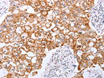 TNFAIP1 Antibody