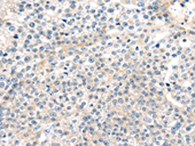 TNFAIP8 Antibody