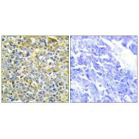 TNFAIP8 antibody