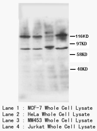 TNF Receptor II/TNFRSF1B Antibody