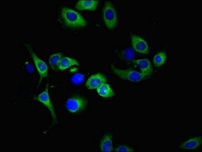 TNFRSF10A antibody