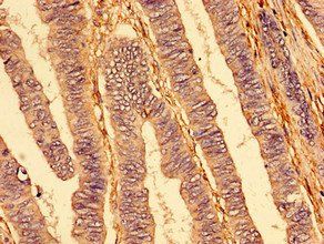 TNFRSF10A Antibody