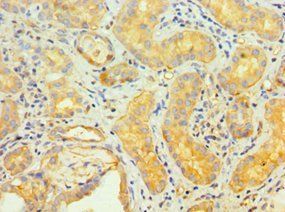 TNFRSF10D Antibody