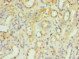 TNFRSF10D Antibody