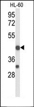 TNFRSF10D antibody