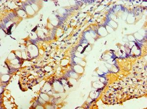 TNFRSF13B Antibody