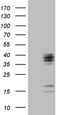 TNFRSF14 Antibody