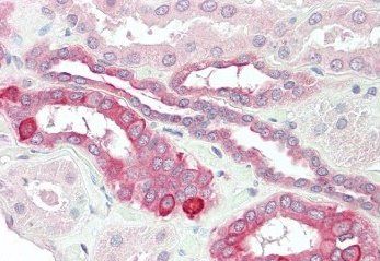Goat anti-HVEM / TR2 Antibody