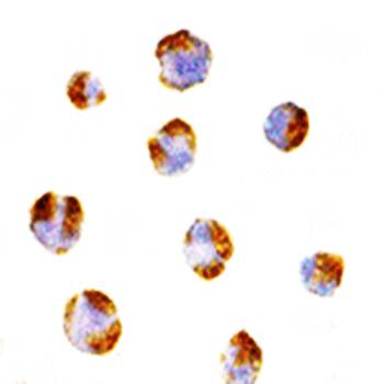 TNFRSF14 Antibody