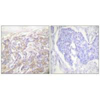 TNFRSF1A Antibody