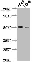 TNFRSF1A antibody