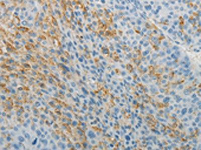 TNFRSF1B Antibody
