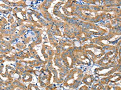 TNFRSF21 Antibody