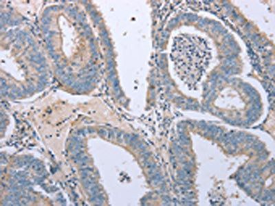 TNFRSF25 Antibody
