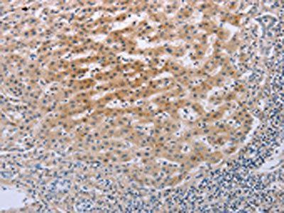 TNFRSF25 antibody